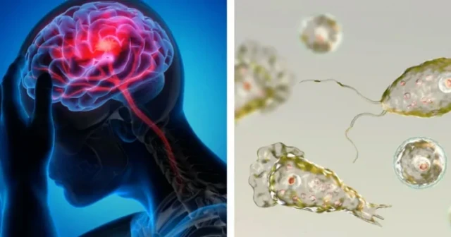 brain virus-Hqmw7eUMoK.webp