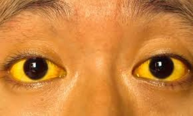 images (3)-eIECeod4Mw.jpg